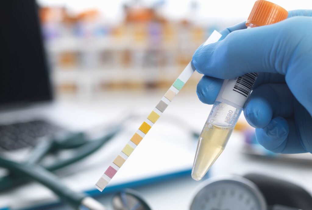 ultimate synthetic urine solution